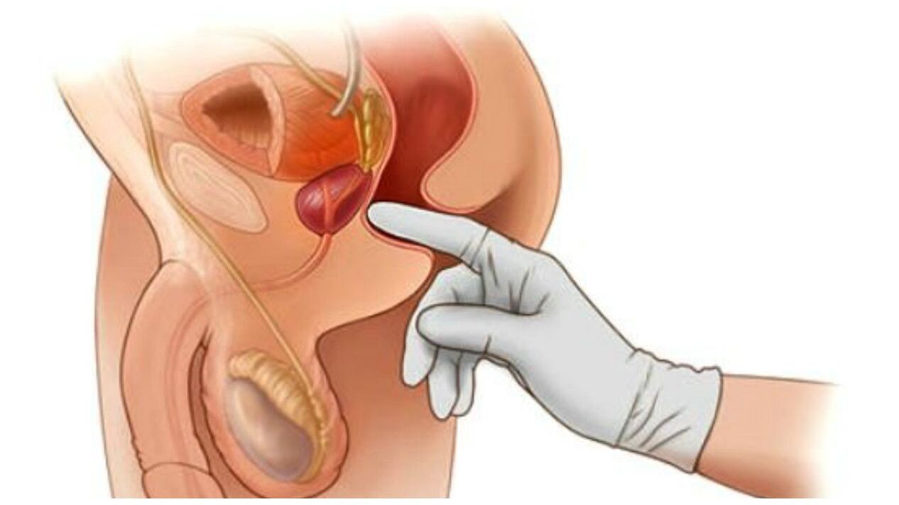 masaż prostaty dla mężczyzn